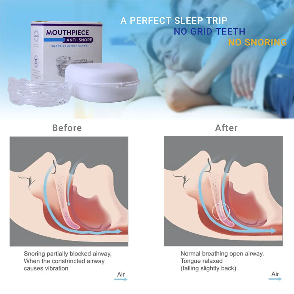 MOUTHPIECE™ Snore Solution Expert