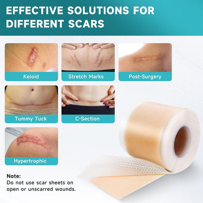 Silicone Scar Sheets