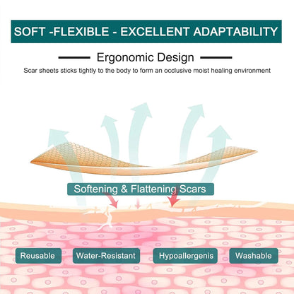Silicone Scar Sheets