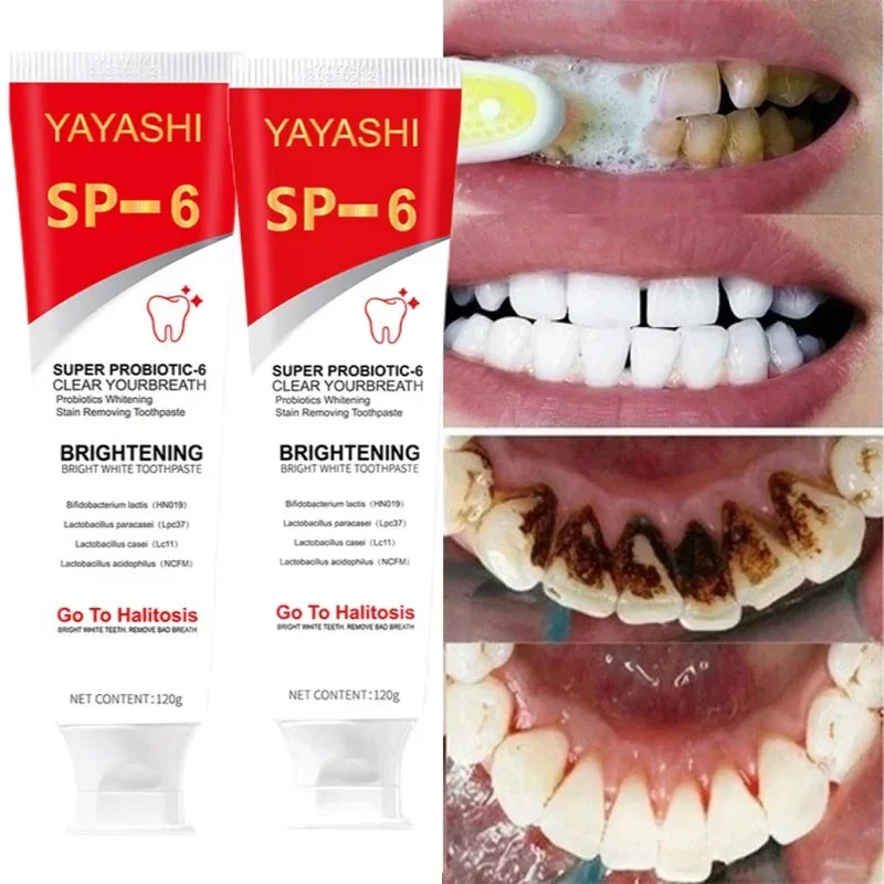 Super Probiotic-6 Toothpaste with 6 Probiotics Oalance Oral Microbiota Strength