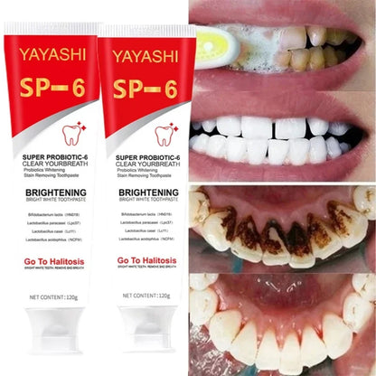 Super Probiotic-6 Toothpaste with 6 Probiotics Oalance Oral Microbiota Strength