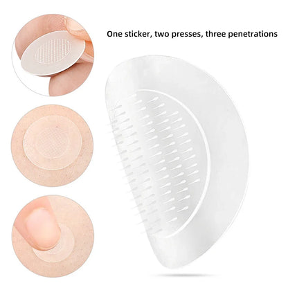 Microneedle Removal Patches