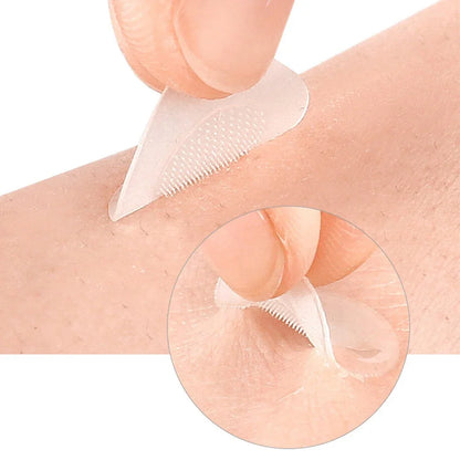 Microneedle Removal Patches