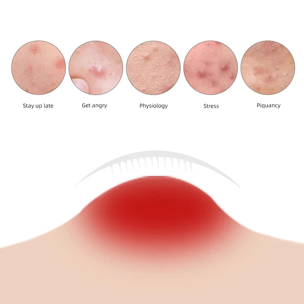Microneedle Removal Patches