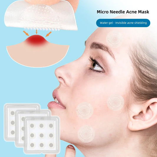 Microneedle Removal Patches