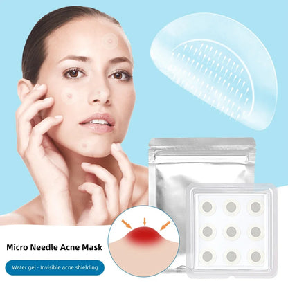 Microneedle Removal Patches